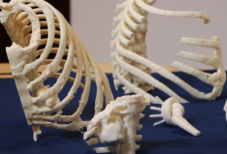 Del escáner al bisturí: El impacto de los modelos impresos en 3D en el quirófano